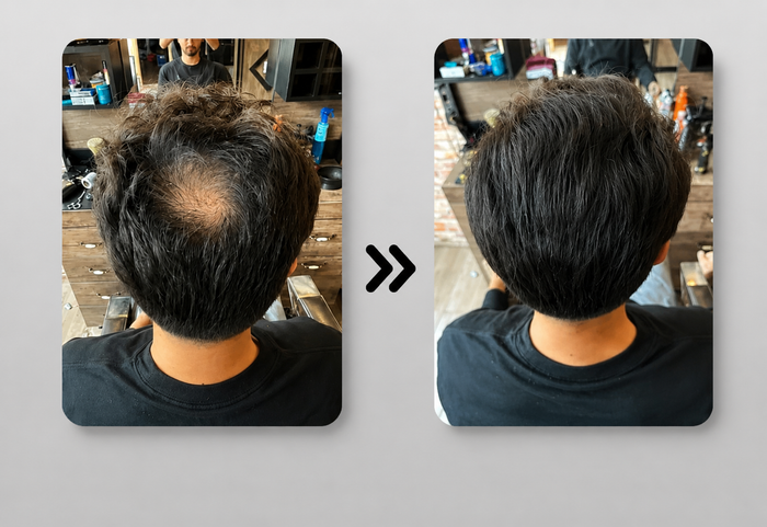 MensMen Magicolour Hairconcealer: La Solución Moderna e Inteligente para el Cabello Fino